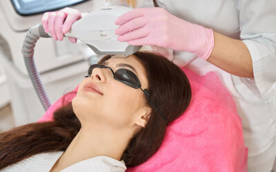Lumecca IPL for Sun Damage: How It Can Help