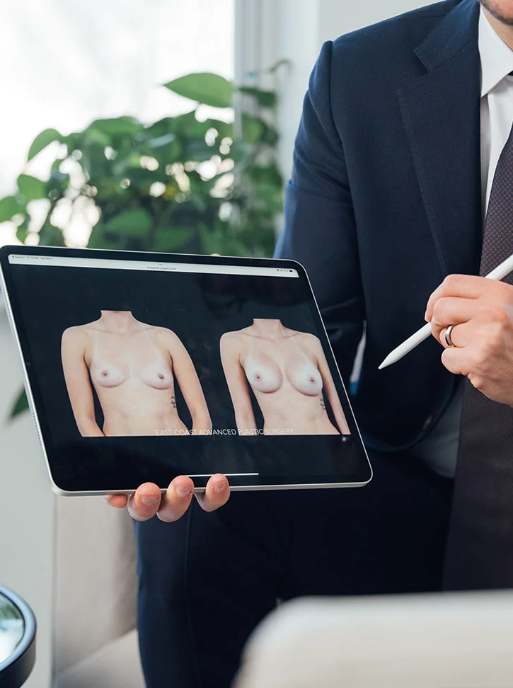A person in a dark suit holds a tablet showing side-by-side before-and-after images of a woman’s upper body, likely from a breast augmentation procedure. Another suited individual stands nearby, holding a white stylus and looking at the tablet. The background features greenery and light-colored walls, with the foreground focused on their hands and clothing. - Breast Fat Grafting in New York, NY